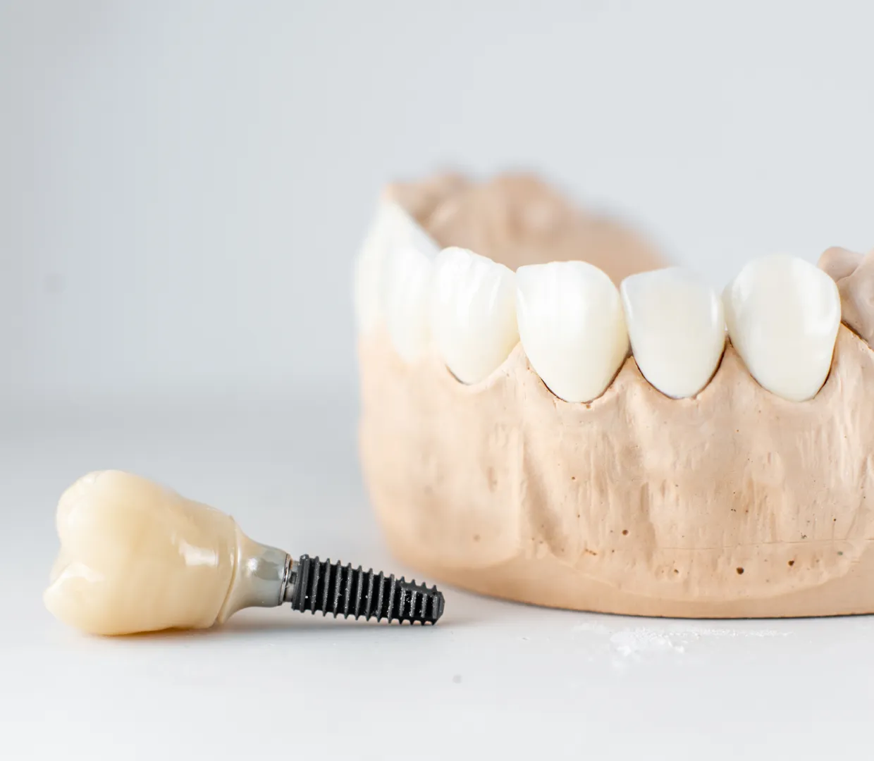 「歯がボロボロ」「歯を失った」「噛めない」──その不安に応える治療