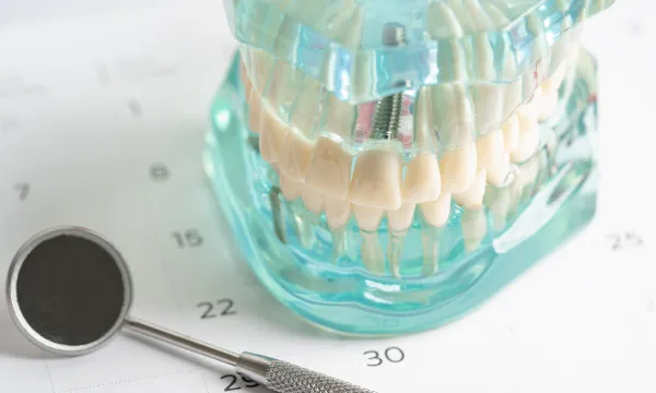 メインテナンス