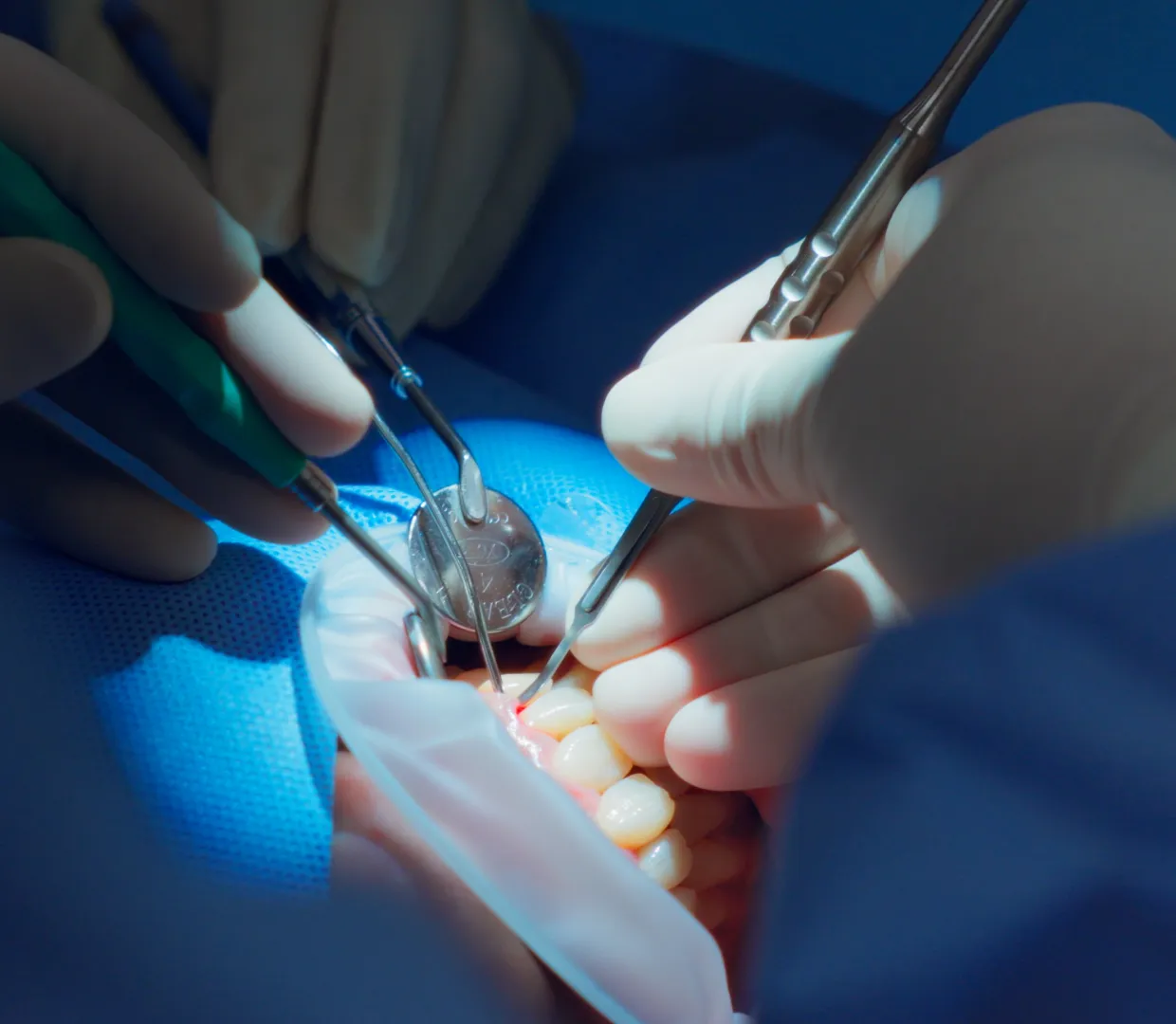 大杉歯科医院が選ばれる理由──院長の一貫執刀×精密診断