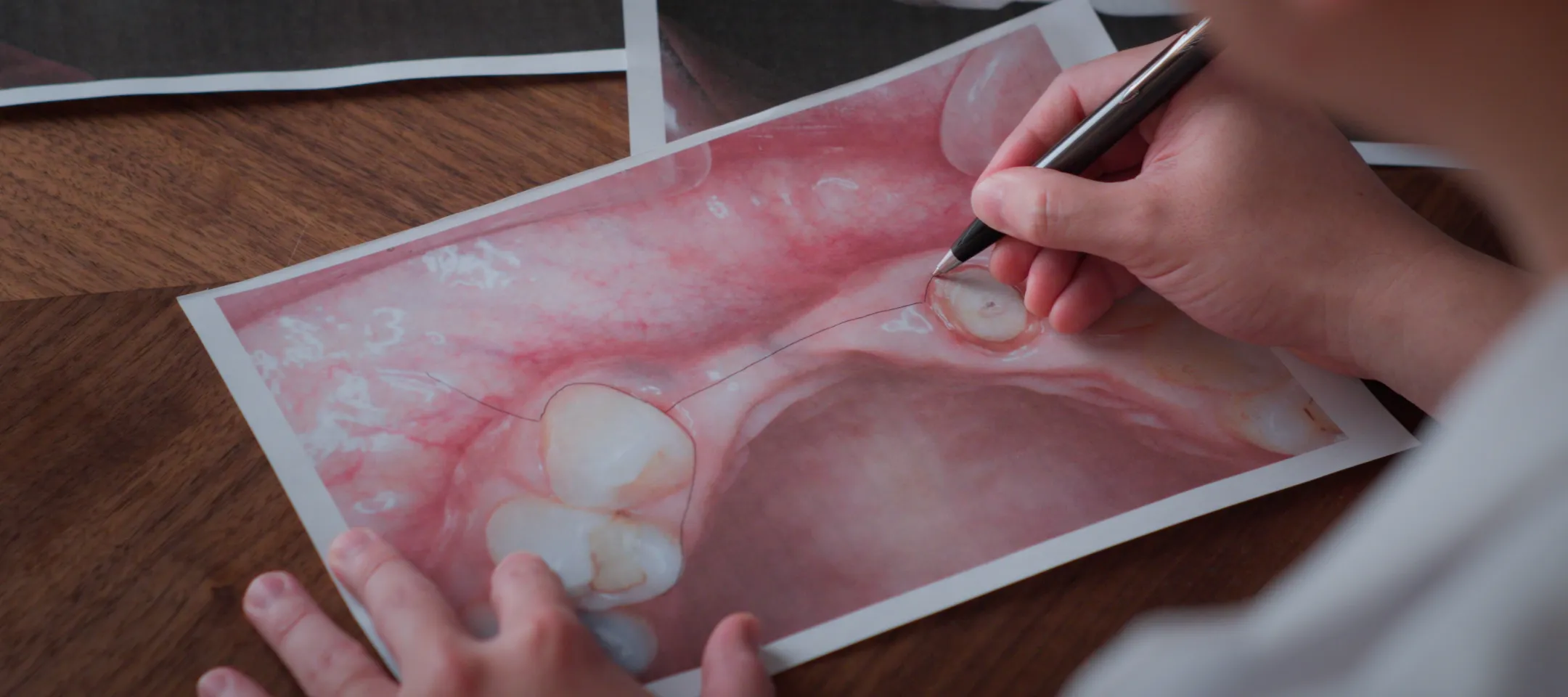 カウンセリングから補綴まで、院長がすべてを担う