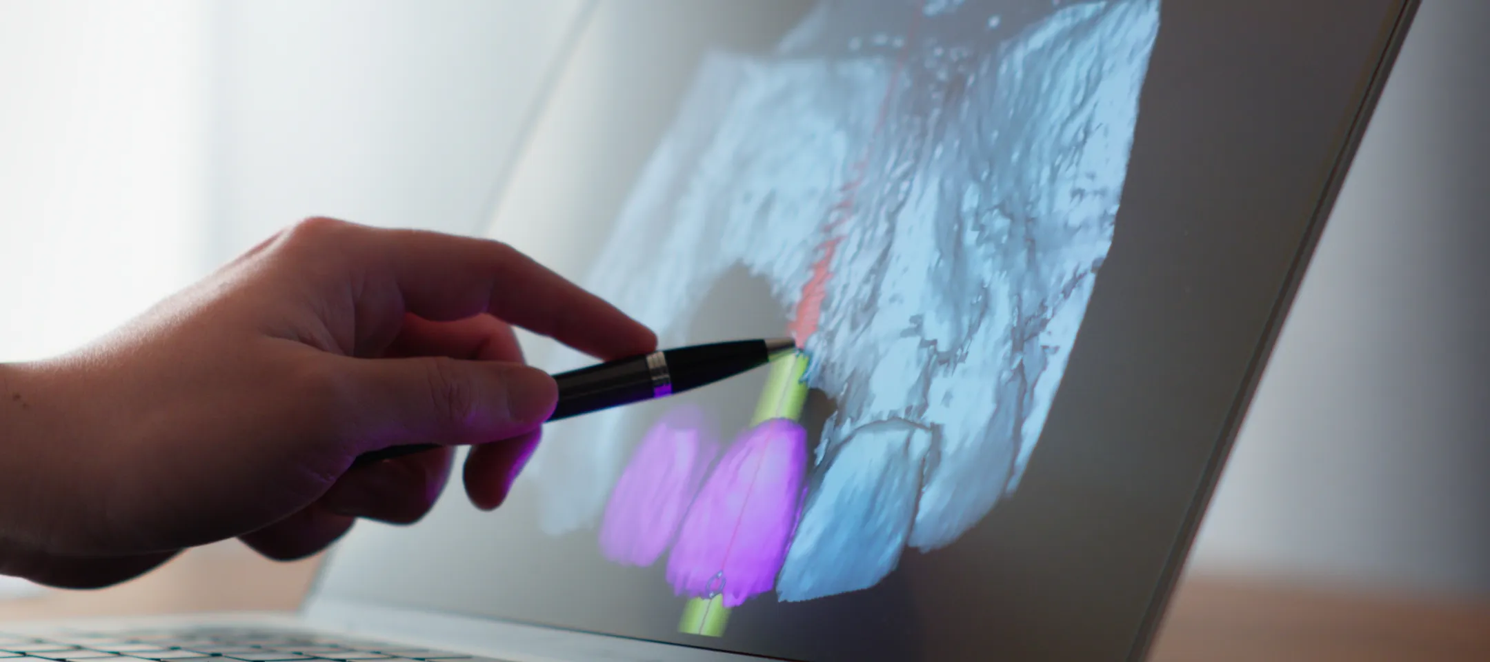 CT・マイクロスコープを駆使した精密な診断と治療