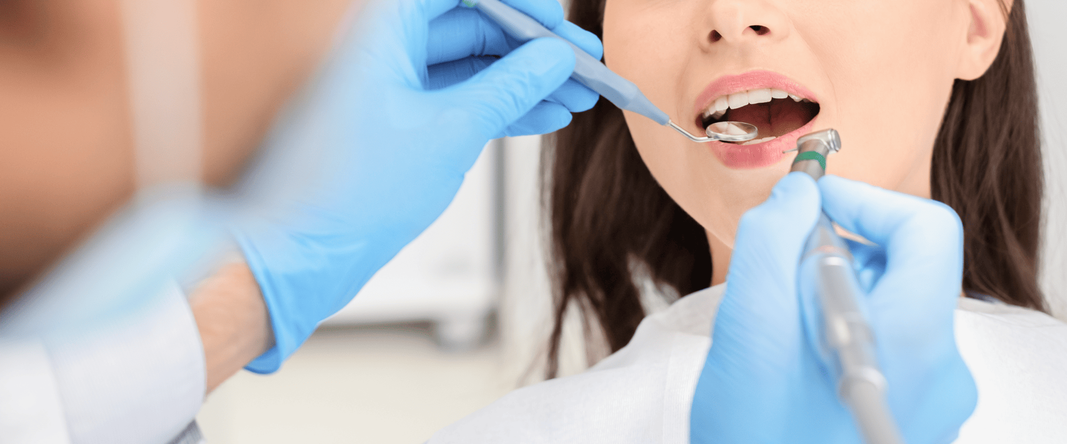 治療後のメンテナンスとと定期検診の重要性