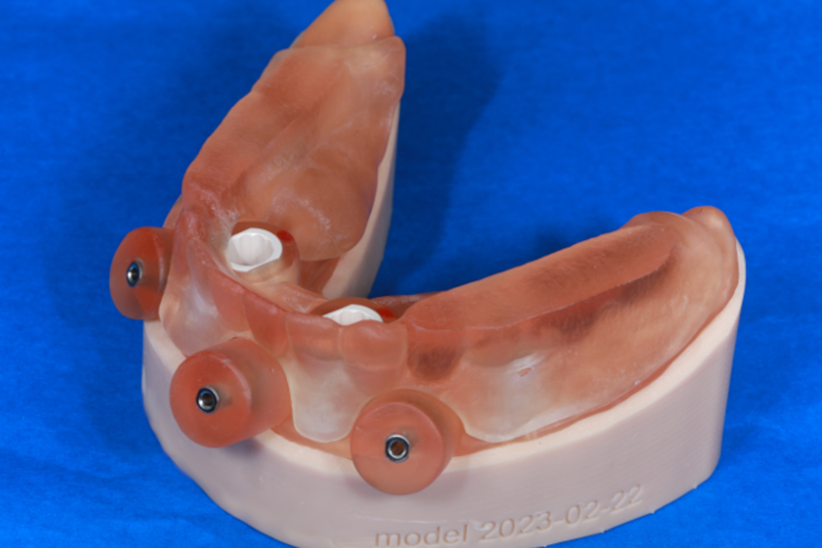 サージカルガイド